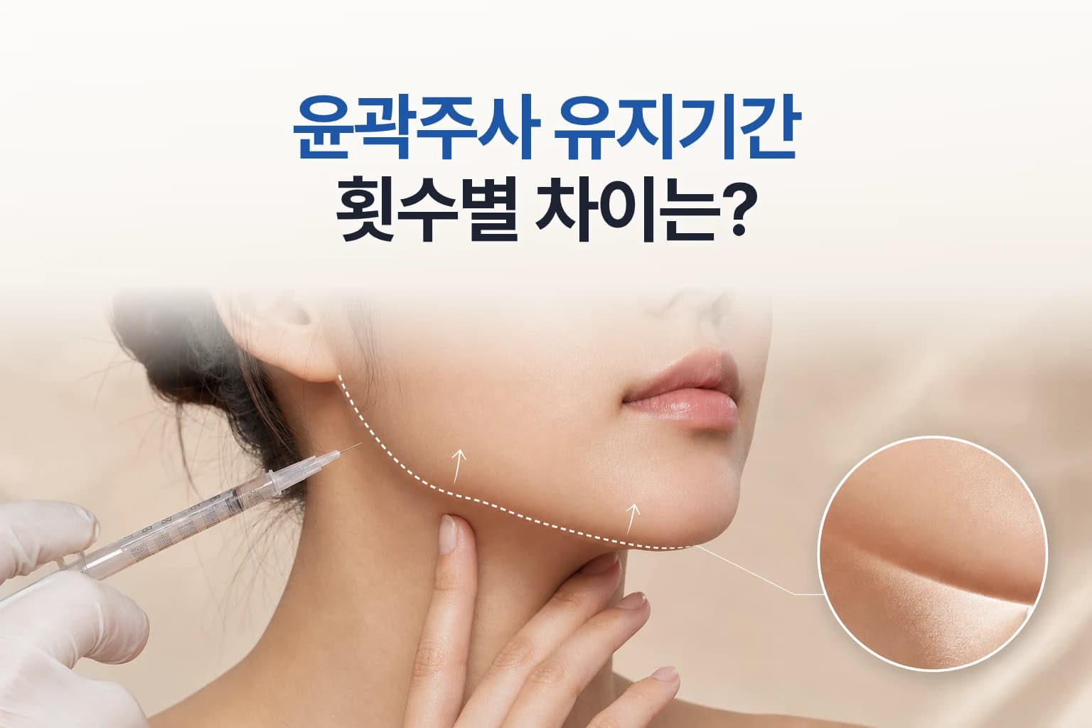 윤곽주사 주사기와 턱선 크롭 사진으로 시술 횟수에 따른 유지기간 차이를 보여주는 썸네일